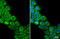 Cholinergic Receptor Muscarinic 3 antibody, GTX111637, GeneTex, Immunofluorescence image 