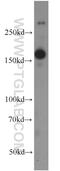 Glutamate Ionotropic Receptor NMDA Type Subunit 2B antibody, 19954-1-AP, Proteintech Group, Western Blot image 
