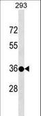 Testis Specific Protein Y-Linked 3 antibody, LS-C157290, Lifespan Biosciences, Western Blot image 