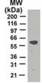 TNF Receptor Associated Factor 2 antibody, NB100-56715, Novus Biologicals, Western Blot image 