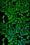 Proteasome 26S Subunit, Non-ATPase 2 antibody, A06642-1, Boster Biological Technology, Western Blot image 