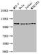 EPH Receptor B3 antibody, LS-C670118, Lifespan Biosciences, Western Blot image 