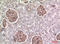 Bone Marrow Stromal Cell Antigen 2 antibody, STJ97307, St John