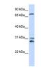 Tousled Like Kinase 2 antibody, NBP1-54355, Novus Biologicals, Western Blot image 