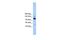 RNA Polymerase III Subunit B antibody, PA5-43229, Invitrogen Antibodies, Western Blot image 