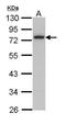 Calpain 3 antibody, GTX113398, GeneTex, Western Blot image 
