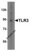 Toll Like Receptor 3 antibody, 3645, ProSci Inc, Western Blot image 