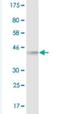 Tyrosine 3-Monooxygenase/Tryptophan 5-Monooxygenase Activation Protein Eta antibody, H00007533-M07, Novus Biologicals, Western Blot image 
