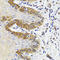 Esterase D antibody, STJ27984, St John