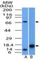 DNA Nucleotidylexotransferase antibody, NBP2-31368, Novus Biologicals, Western Blot image 