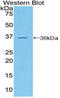 Melanoma Cell Adhesion Molecule antibody, MBS2001427, MyBioSource, Western Blot image 