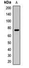 FUS RNA Binding Protein antibody, LS-C668376, Lifespan Biosciences, Western Blot image 