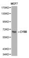 Cytochrome B-245 Beta Chain antibody, LS-C192744, Lifespan Biosciences, Western Blot image 