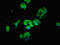 Metaxin 2 antibody, LS-C676096, Lifespan Biosciences, Immunofluorescence image 