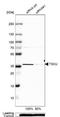 Tsukushi, Small Leucine Rich Proteoglycan antibody, NBP1-87959, Novus Biologicals, Western Blot image 