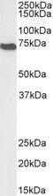 Anti-Mullerian Hormone Receptor Type 2 antibody, 43-650, ProSci, Western Blot image 