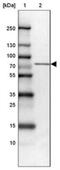 Lymphocyte Cytosolic Protein 2 antibody, NBP1-87032, Novus Biologicals, Western Blot image 