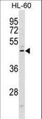 Chemerin Chemokine-Like Receptor 1 antibody, LS-C157651, Lifespan Biosciences, Western Blot image 