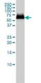 Glucosylceramidase Beta antibody, H00002629-M01, Novus Biologicals, Western Blot image 