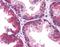 Transmembrane Protein 38B antibody, orb94349, Biorbyt, Immunohistochemistry paraffin image 