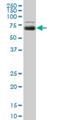 UDP-N-acetylglucosamine: alpha-1,3-D-mannoside beta-1,4-N-acetylglucosaminyltransferase IVa antibody, H00011320-M01, Novus Biologicals, Western Blot image 