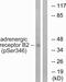 Adrenoceptor Beta 2 antibody, PA5-38728, Invitrogen Antibodies, Western Blot image 