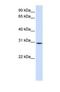 Sushi Domain Containing 6 antibody, NBP1-69581, Novus Biologicals, Western Blot image 