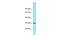 Aminoacylase 3 antibody, A11888, Boster Biological Technology, Western Blot image 