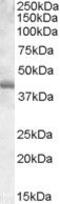 Spi-1 Proto-Oncogene antibody, PA5-18908, Invitrogen Antibodies, Western Blot image 