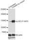 ATP Citrate Lyase antibody, LS-C750588, Lifespan Biosciences, Western Blot image 
