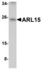 ADP Ribosylation Factor Like GTPase 15 antibody, MBS151057, MyBioSource, Western Blot image 