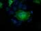 Profilin 1 antibody, MA5-25120, Invitrogen Antibodies, Immunocytochemistry image 