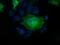 Profilin 1 antibody, MA5-25120, Invitrogen Antibodies, Immunocytochemistry image 