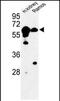 Cystathionine-Beta-Synthase antibody, PA5-72505, Invitrogen Antibodies, Western Blot image 