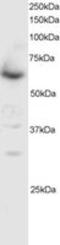 SMAD Family Member 4 antibody, MBS421353, MyBioSource, Western Blot image 