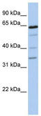 Polypeptide N-Acetylgalactosaminyltransferase 16 antibody, TA338430, Origene, Western Blot image 