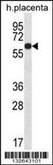 Glucocorticoid-induced transcript 1 protein antibody, 56-701, ProSci, Western Blot image 