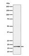 Prolactin Induced Protein antibody, M04543-2, Boster Biological Technology, Western Blot image 