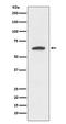 Keratin 9 antibody, M03692, Boster Biological Technology, Western Blot image 
