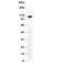 Dihydropyrimidine Dehydrogenase antibody, R30854, NSJ Bioreagents, Western Blot image 