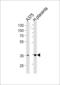 Aldose reductase antibody, 61-465, ProSci, Western Blot image 