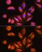 Exosome Component 2 antibody, GTX64892, GeneTex, Immunofluorescence image 