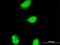 ALX Homeobox 1 antibody, H00008092-M02, Novus Biologicals, Immunocytochemistry image 