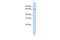 TRNA Methyltransferase 5 antibody, GTX46177, GeneTex, Western Blot image 