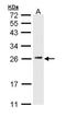 CD3g Molecule antibody, GTX111878, GeneTex, Western Blot image 