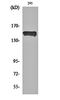 Phospholipase C Gamma 1 antibody, orb159624, Biorbyt, Western Blot image 