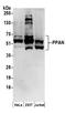 Peter Pan Homolog antibody, A304-598A, Bethyl Labs, Western Blot image 