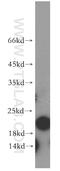 ADP Ribosylation Factor 5 antibody, 20227-1-AP, Proteintech Group, Western Blot image 