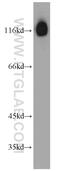 BAF Chromatin Remodeling Complex Subunit BCL11B antibody, 55414-1-AP, Proteintech Group, Western Blot image 