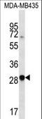 C-X-C Motif Chemokine Receptor 6 antibody, LS-C159423, Lifespan Biosciences, Western Blot image 